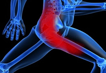 Hábitos diarios para Reducir el Dolor de Ciática