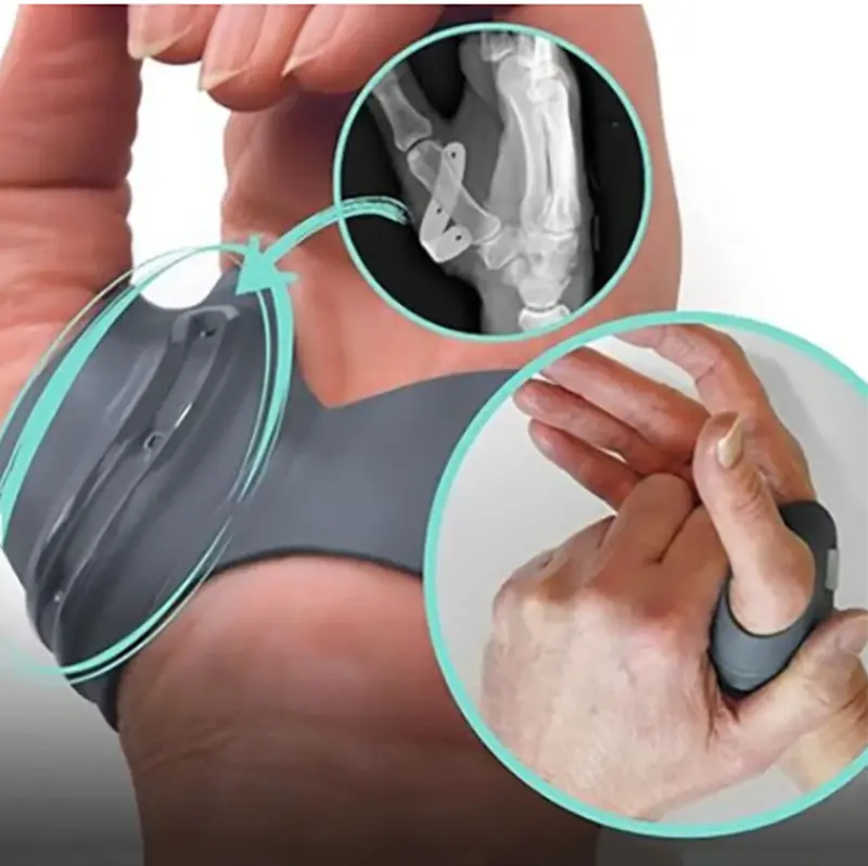 Órtesis de Apoyo Taquey para la Artritis del Pulgar